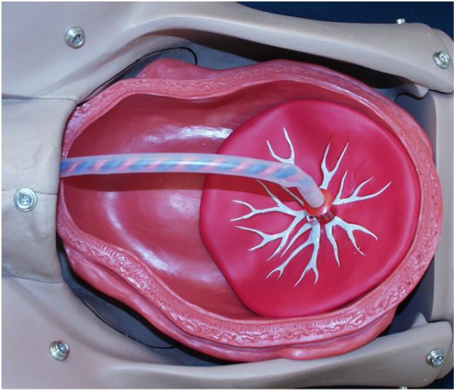 Delivery of the Placenta